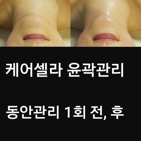 케어셀라뷰티샵 이미지