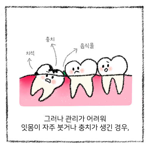 바른연합치과 이미지