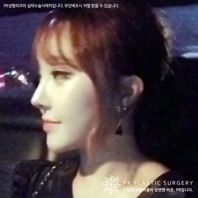고려피알 이미지