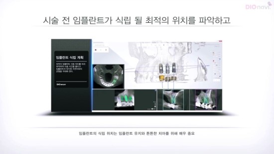 더원연합치과의원 이미지