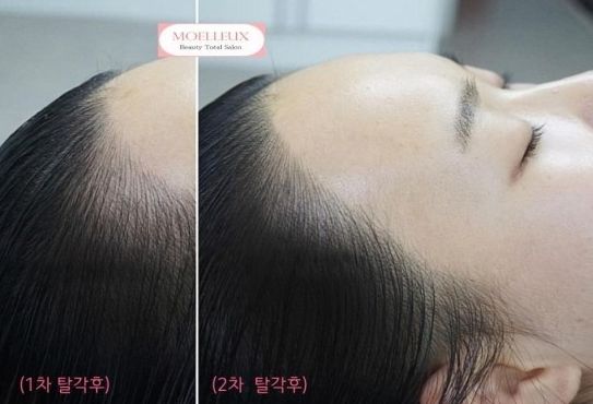 뷰티헤어라인 이미지