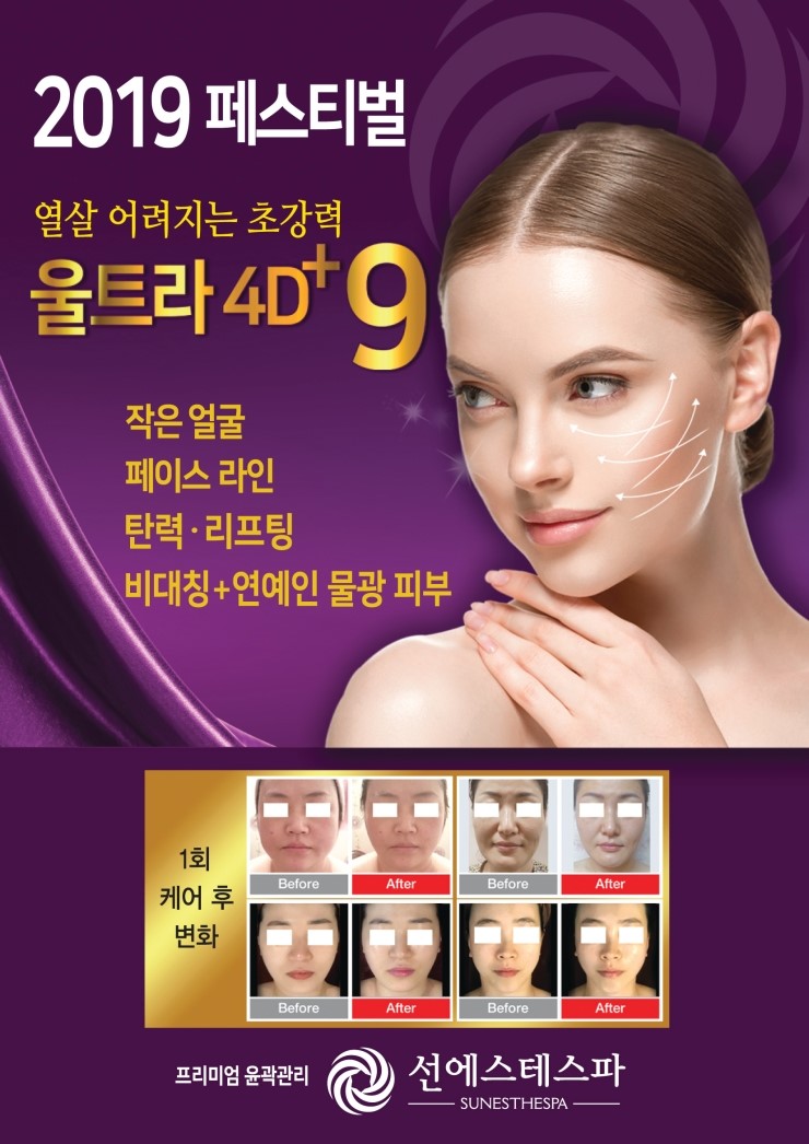 라인에스테 이미지