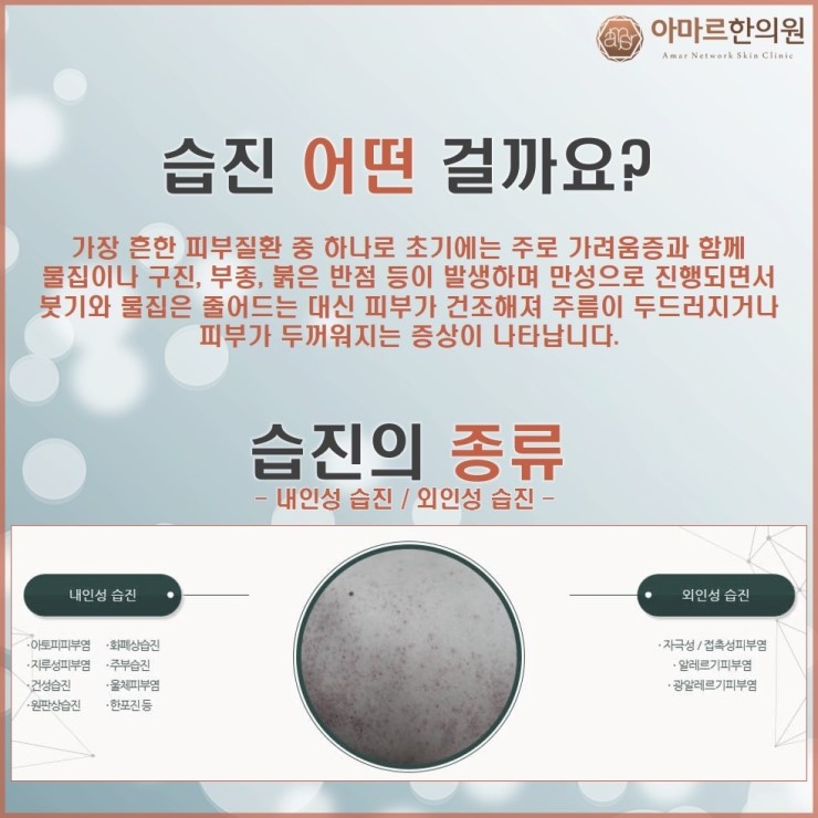 아마르한의원 이미지