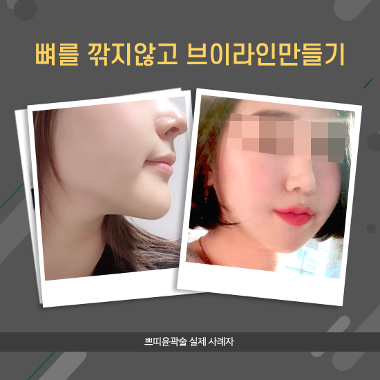 투턱 이미지