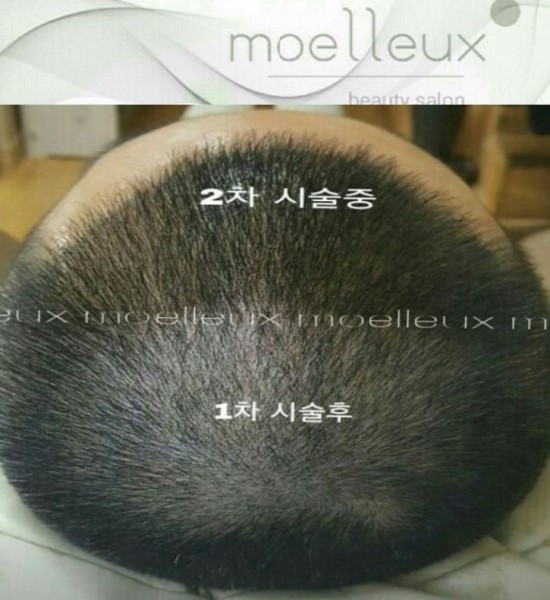 솜씨뷰티 이미지