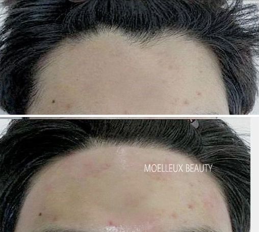 솜씨뷰티 이미지