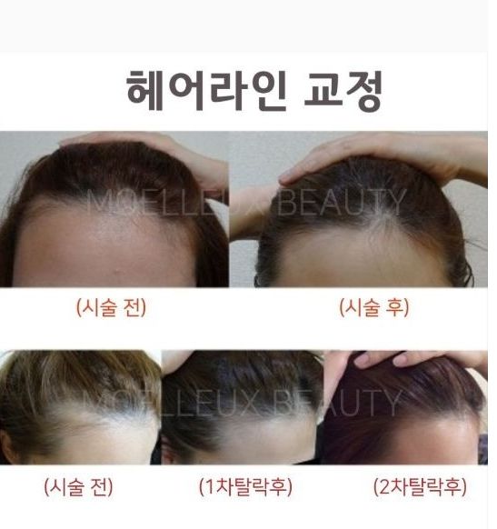 코라인 헤어 이미지