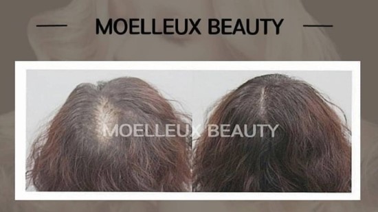 코라인 헤어 이미지