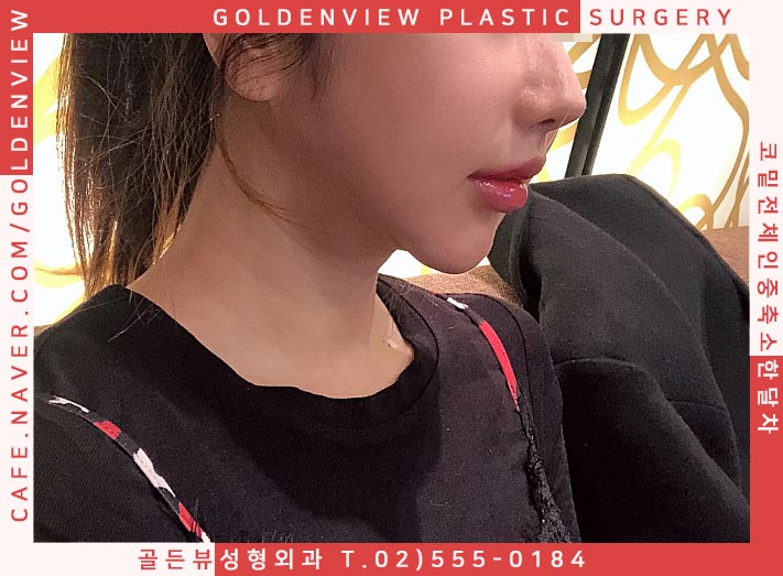 인중 이미지