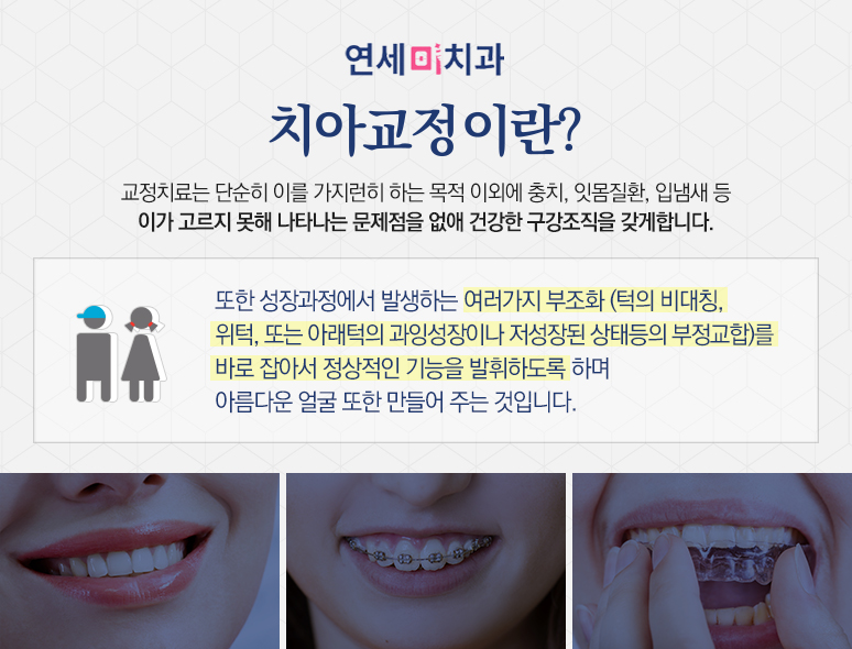 미연세치과 이미지