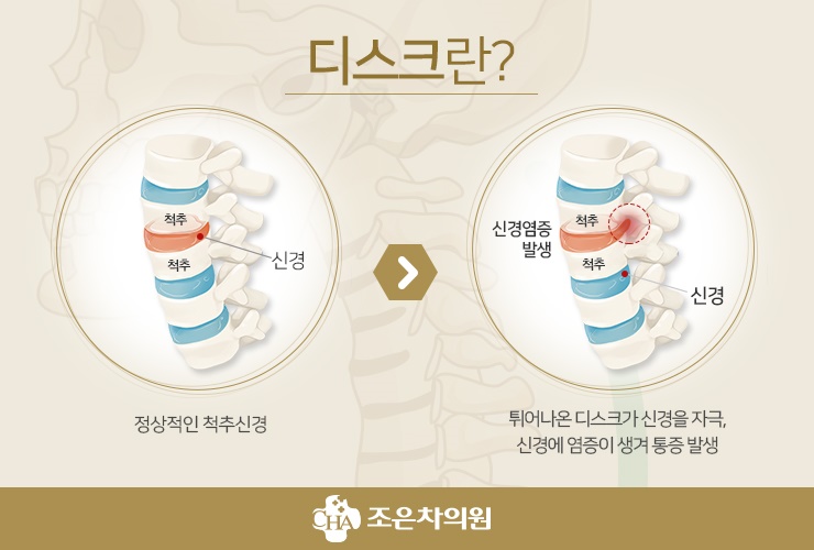 조은차의원 이미지