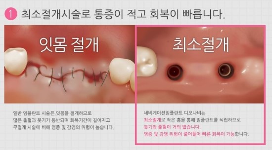 더원연합치과 이미지