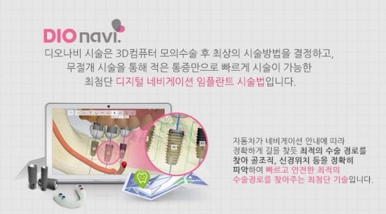더원연합치과 이미지