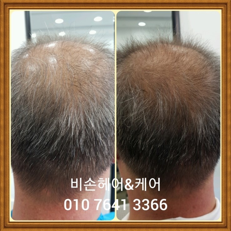 비손헤어&케어 이미지
