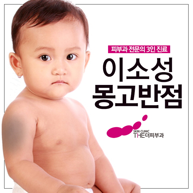 몽고반점 이미지