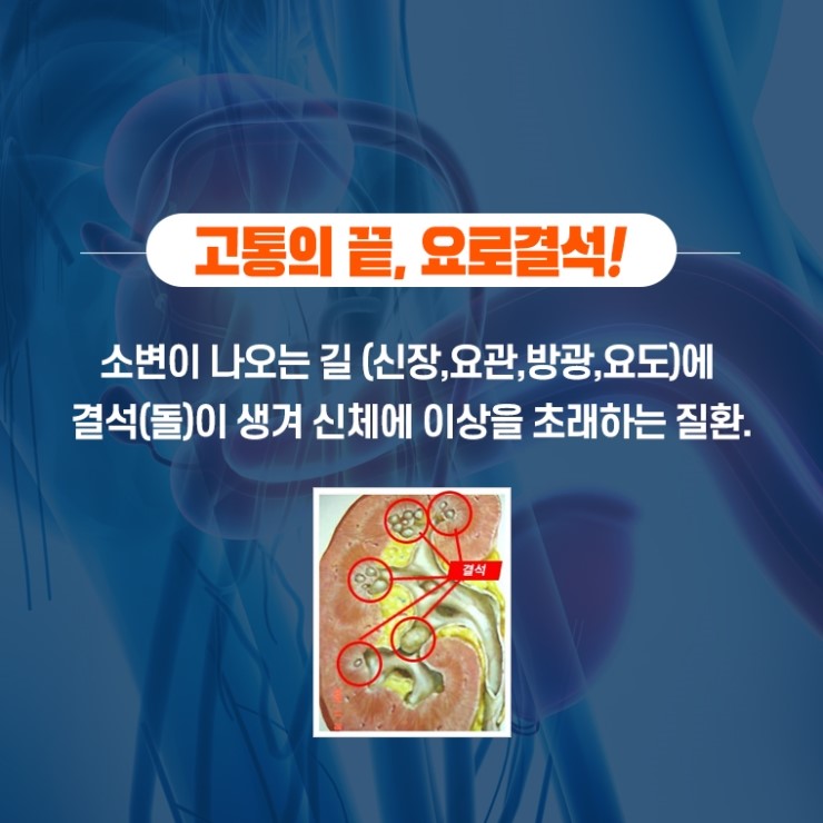 멘파워비뇨기과 이미지