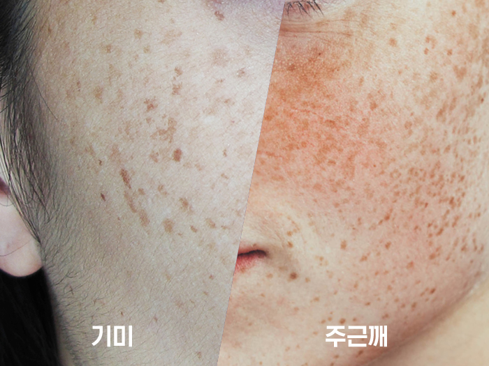 대연류피부과 이미지