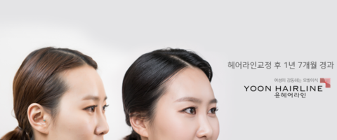 라인헤어 이미지
