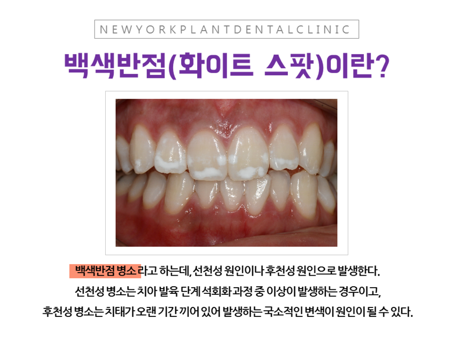 뉴욕화이트치과 이미지