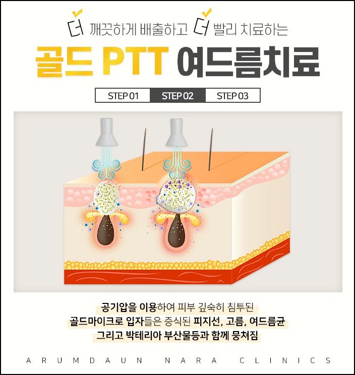 아름다운나라피부과 이미지