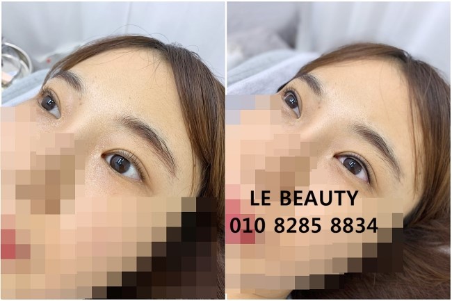 365뷰티라인 이미지
