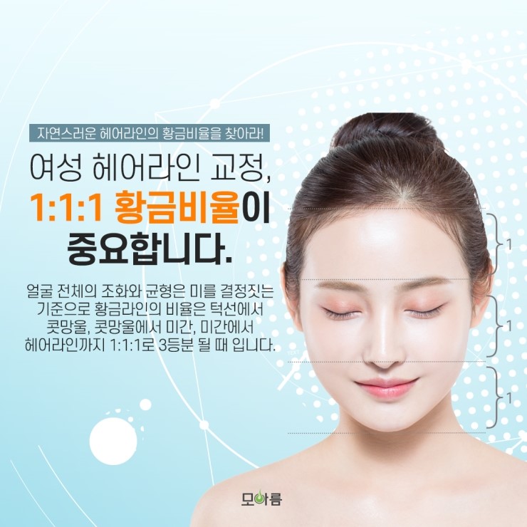 선헤어라인 이미지