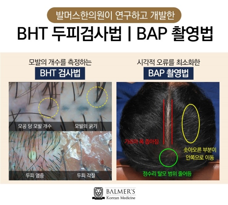 발머스한의원 이미지