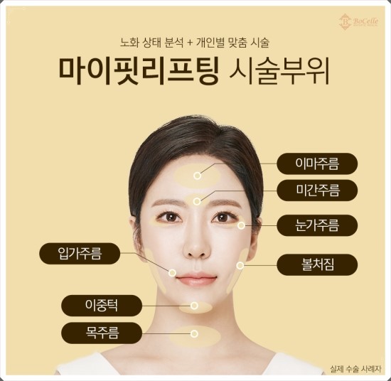 보셀르의원 이미지