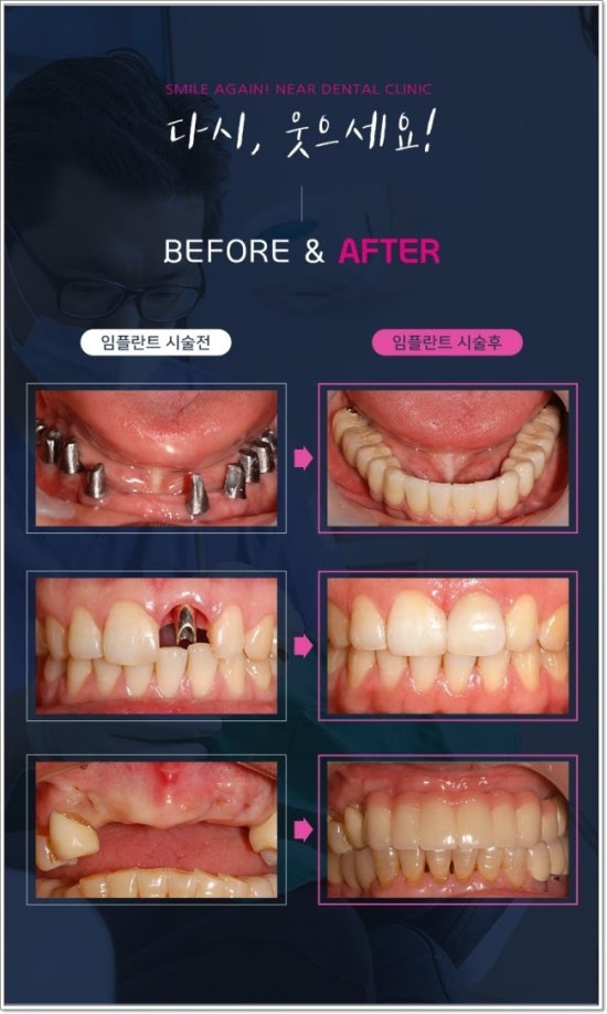 서울니어치과 이미지
