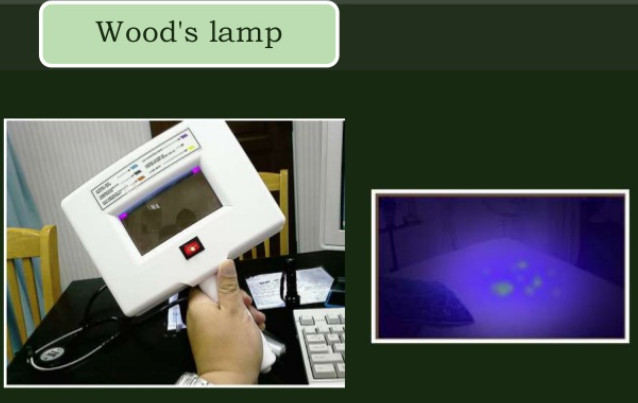 Woods Light Lamp 네이버 블로그 Woods Light Lamp 네이버 블로그, What Type Of Light Does A Woods Lamp Use