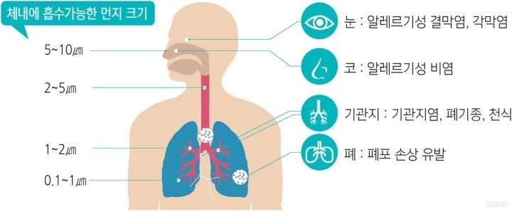 우리크리닝 이미지