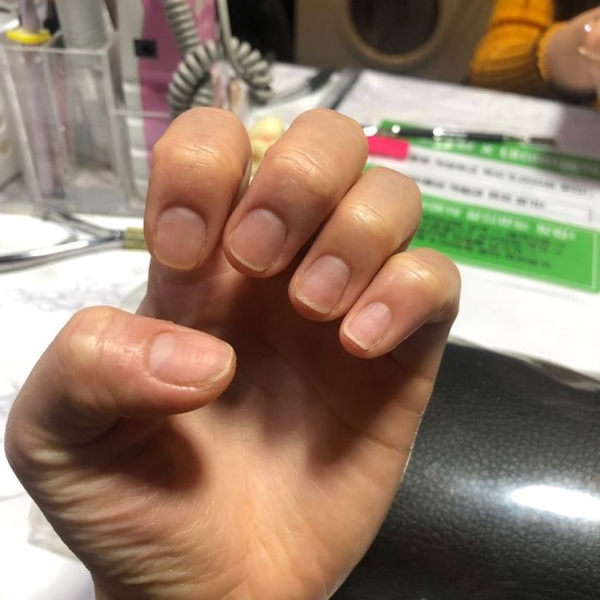보보네일 이미지