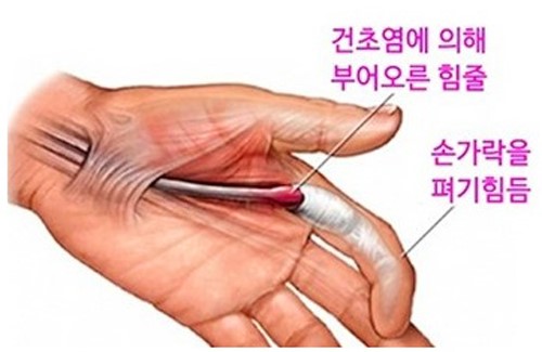 수지정형외과의원 이미지