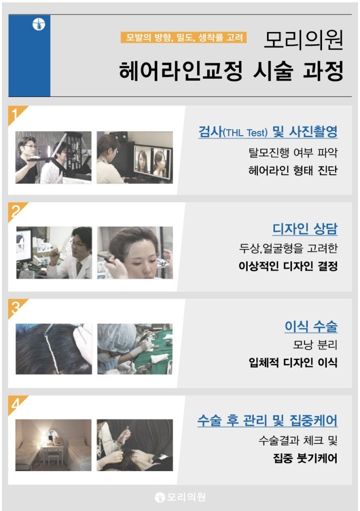 정 헤어라인 이미지