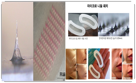 리뉴메디뷰티 이미지