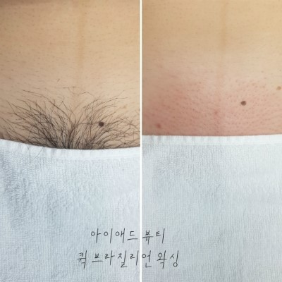 아이애드 이미지