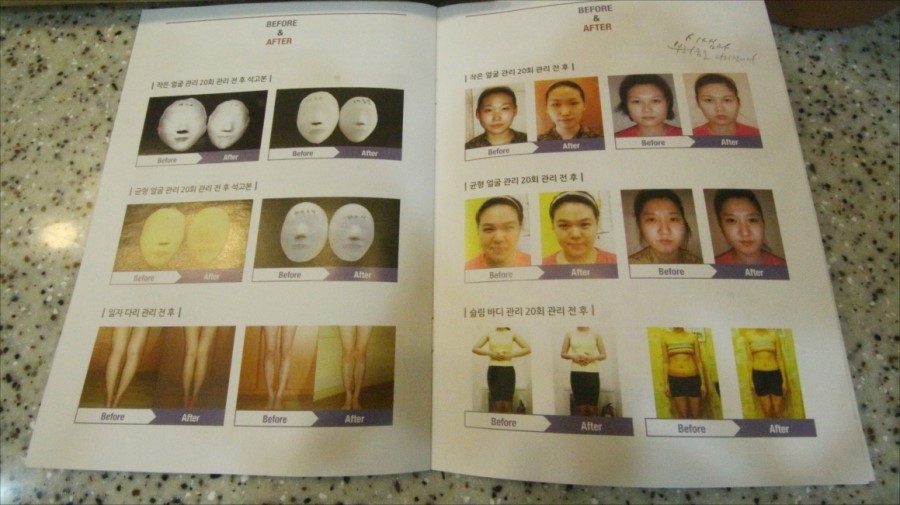 예쁜약손샵 이미지