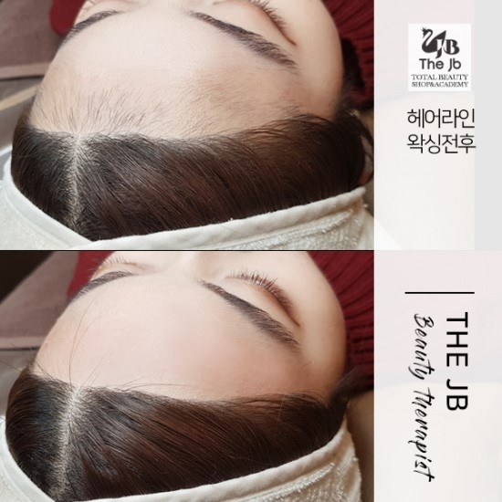 제이비라인 이미지