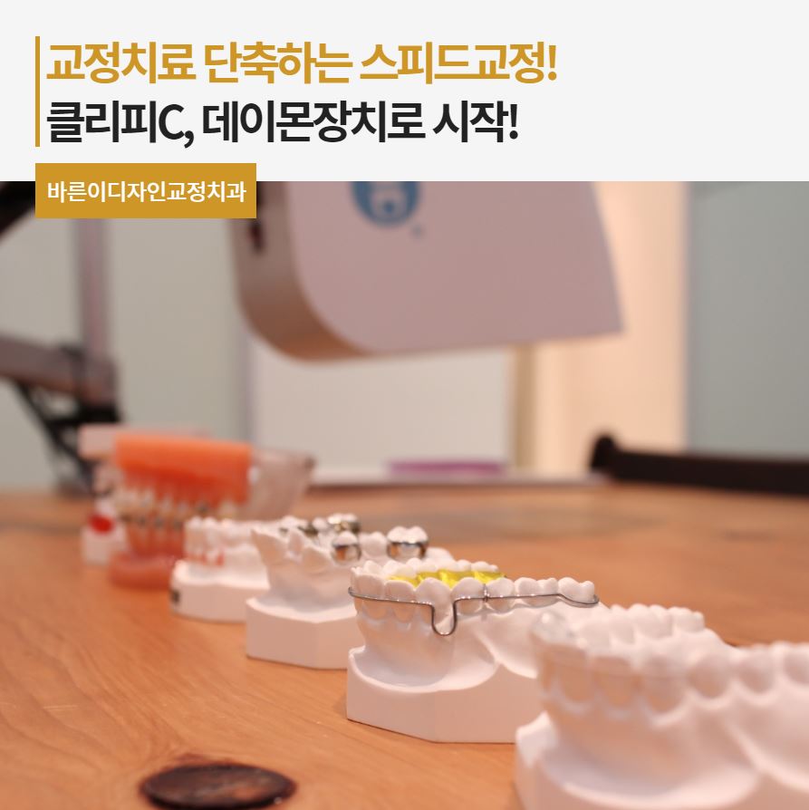 바른이디자인치과교정과 이미지