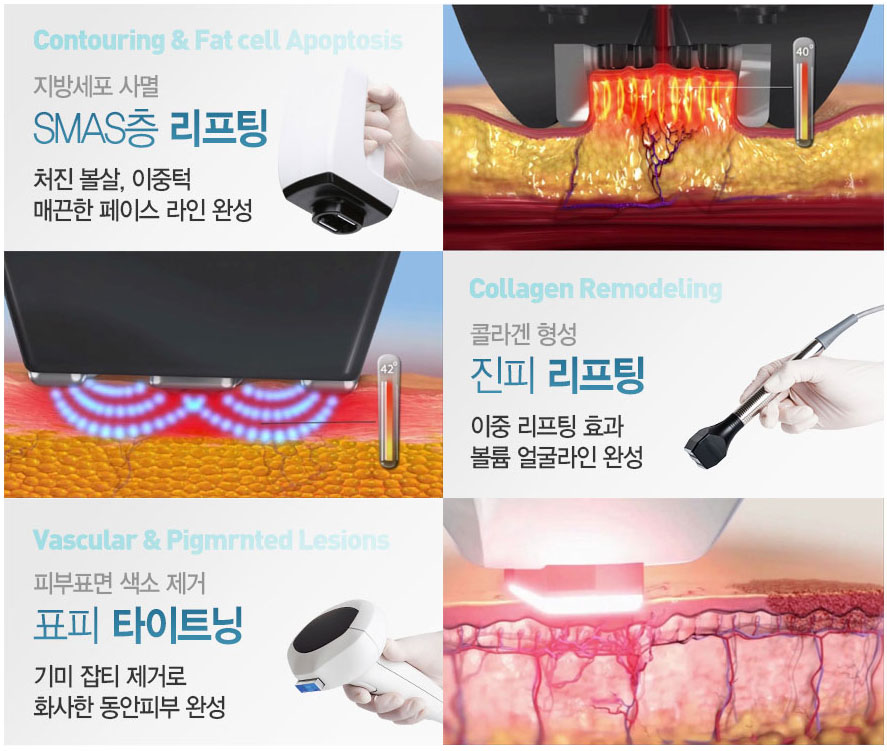 제이티메디칼 이미지