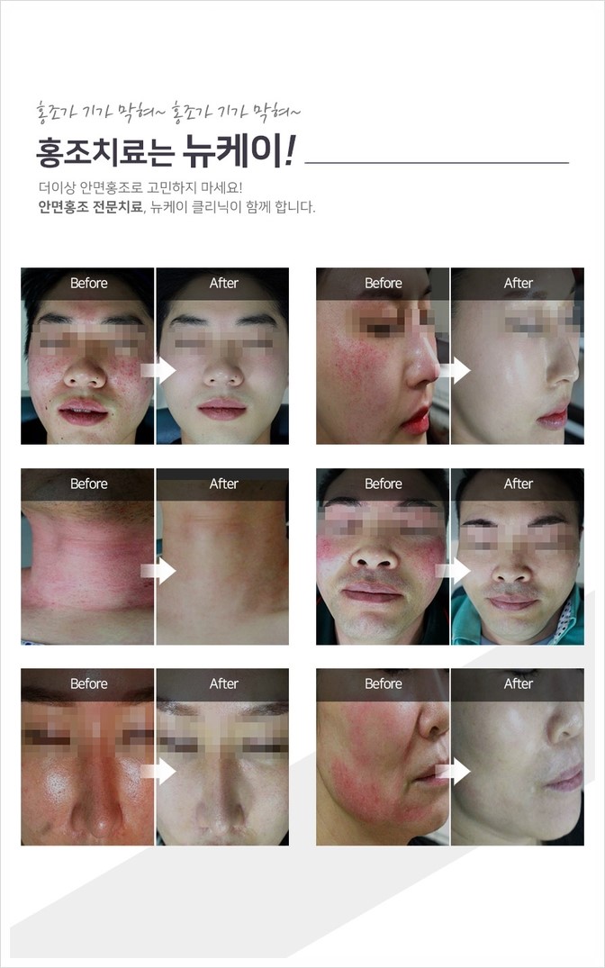 뉴케이의원 이미지