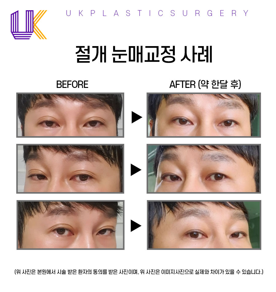 유케이성형외과 이미지