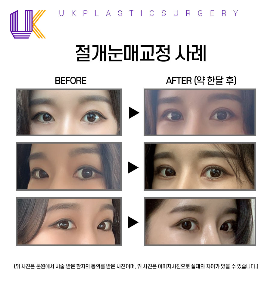 유케이성형외과 이미지