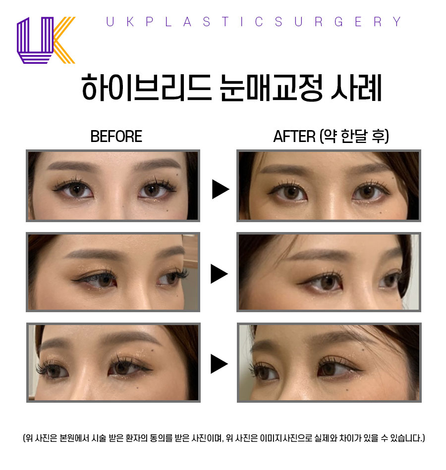 유케이성형외과 이미지