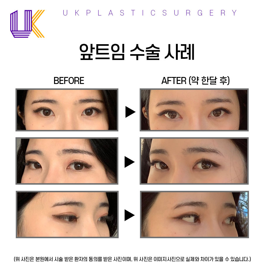 유케이성형외과 이미지