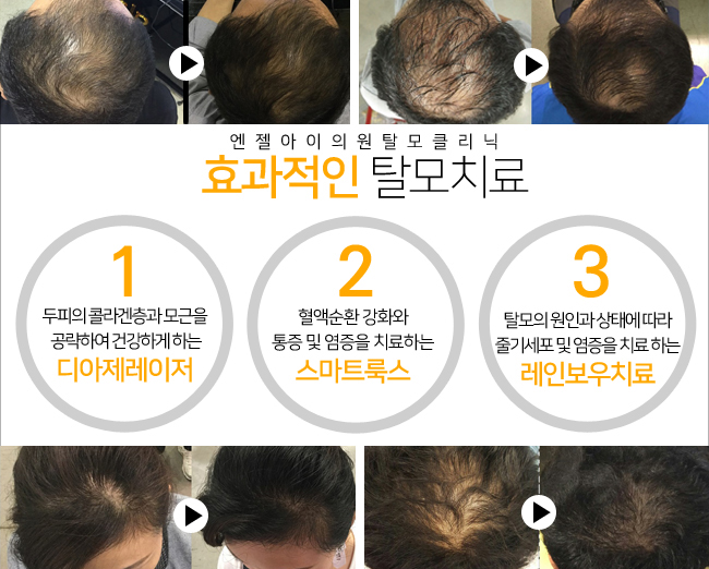 엔젤아이의원 이미지