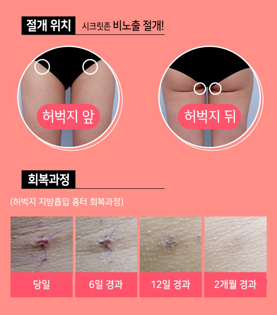 강남더슬림의원 이미지