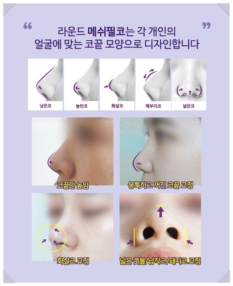 필코모아 이미지