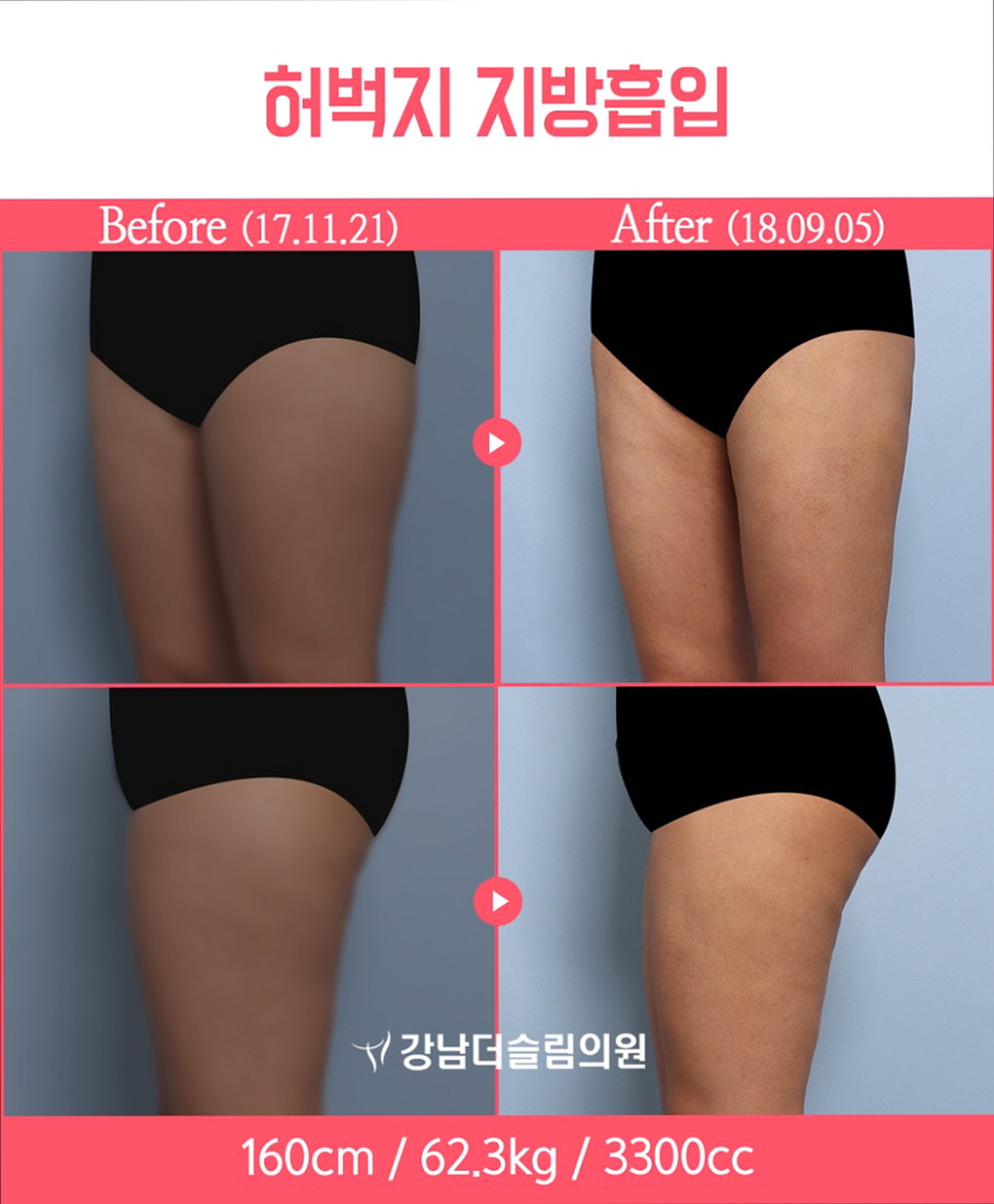 예슬림의원 이미지