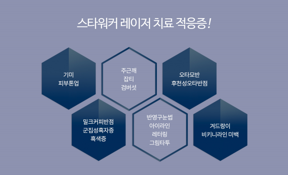 기미미소 이미지